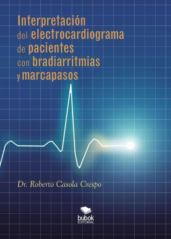 Interpretaci?n del electrocardiograma de pacientes con bradiarritmias y marcapasos | Roberto Casola