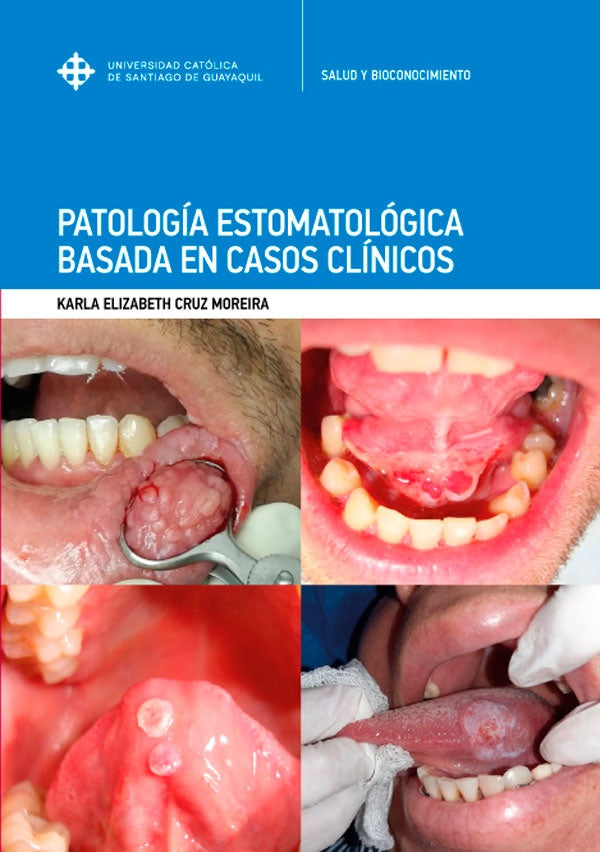 Patologia Estomatologica basada en casos clinicos | KarlaElizabethCruz Moreira