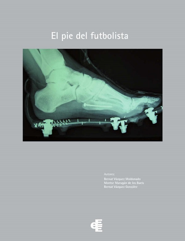 El pie del futbolista | BERNATVaZQUEZ MALDONADO