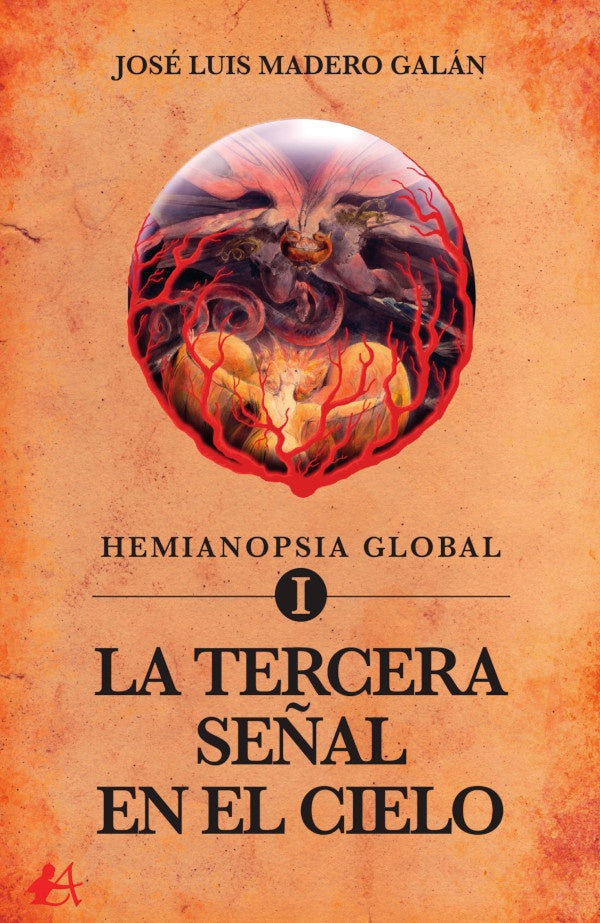 Hemianopsia global I | JoseLuisMadero Galan
