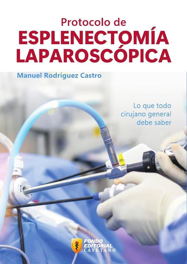Protocolo de esplenectomia laparoscopica | Manuel Rodriguez Castro