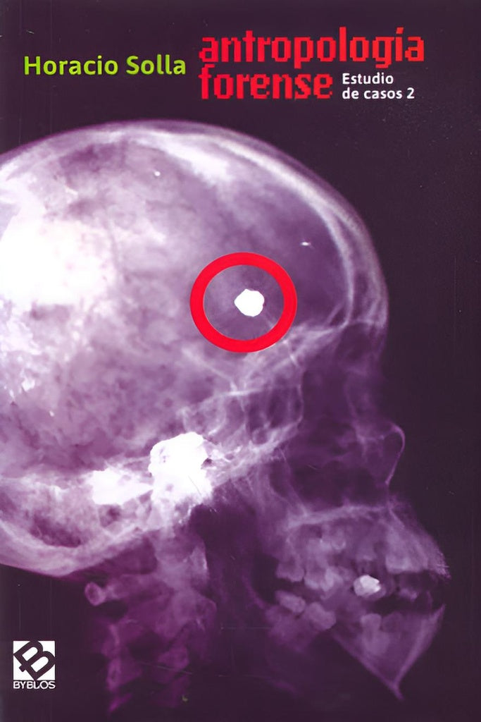 Antropología forense | HORACIO SOLLA
