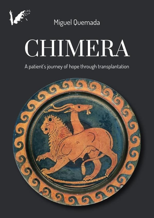 Chimera | MiguelQuemada S?enz-Badillos