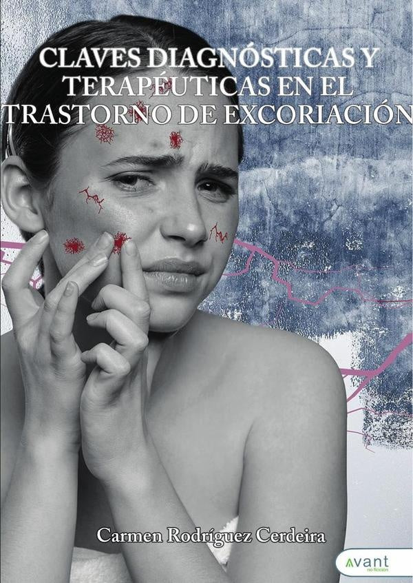 Claves diagn?sticas y terap?uticas en el trastorno de excoriaci?n | CarmenRodr?guez Cerdeira