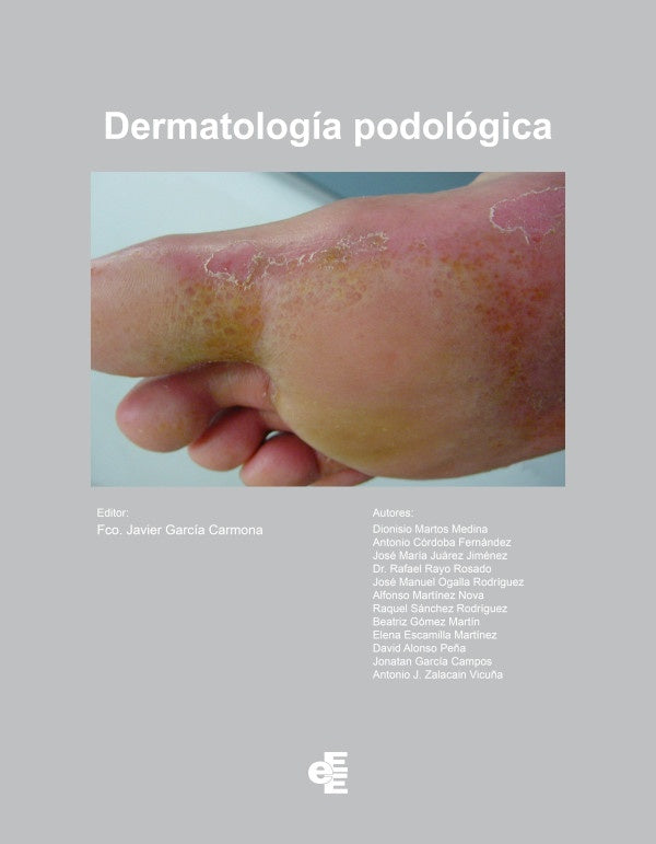 Dermatologia Podologica | Fco.JavierGarcia Carmona