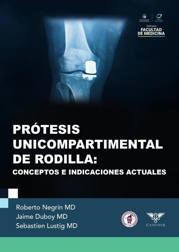Protesis unicompartimental de rodilla | Roberto Negrin