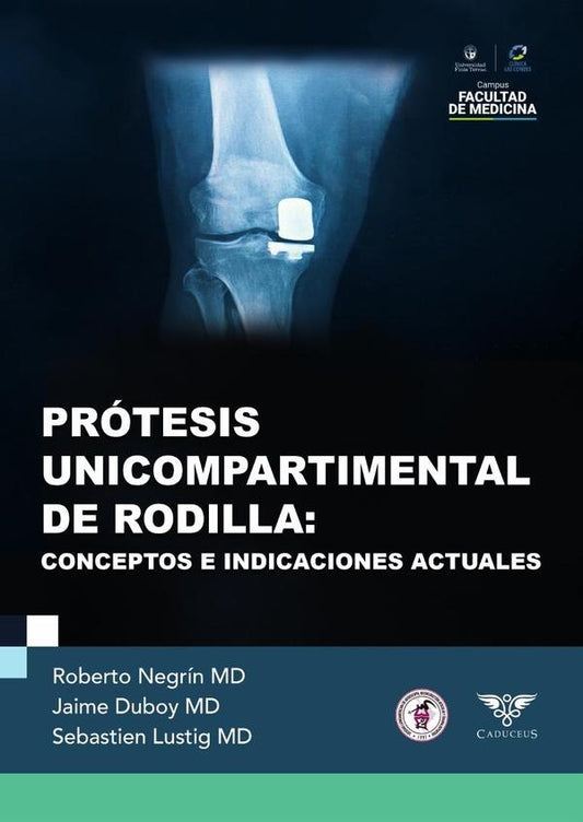 Protesis unicompartimental de rodilla | Roberto Negrin