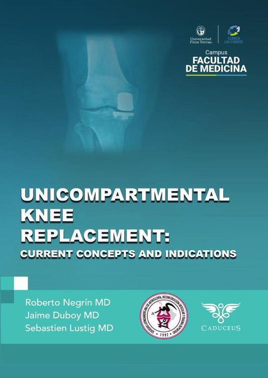 Unicompartmental knee replacement | RobertoNegrin Vyhmeister