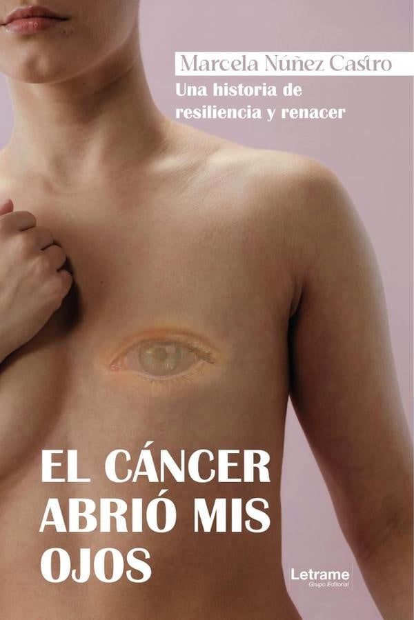 El cancer abrio mis ojos | Marcela Nu?ez Castro